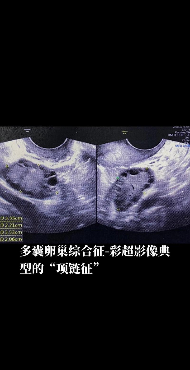 ii彩超技术在现代医学诊断中的应用与价值 必应SEO ii彩超技术在现代医学诊断中的应用与价值 ii彩超技术在现代医学诊断中的应用与价值 必应SEO